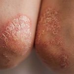 real-world-study-shows