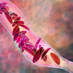 first-patient-cured-of