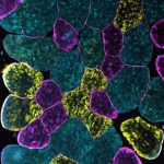 researchers-identify-l-1