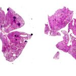 scientists-discover-ho-1