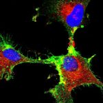 study-identifies-key-p