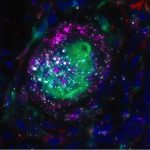 a-gentle-approach-offe