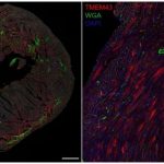 breakthrough-gene-ther