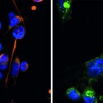 how-breast-cancer-cell