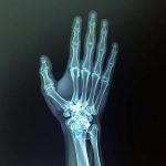 wrist-x-ray