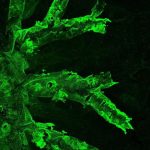 origins-of-common-lung