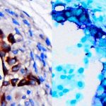 research-alert-gene-si