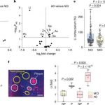 alzheimers-disease-lit