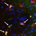 cells-from-the-spleen