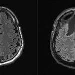 clinical-trial-reveals (1)