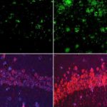 could-lithium-explain