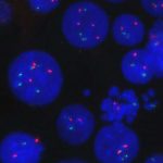 study-explains-how-lym