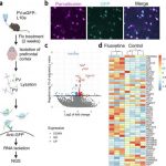 antidepressant-fluoxet