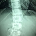 spinalcord (1)