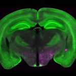 Fluorescent-Brain-Imaging-NPY-Neurons-1200x675