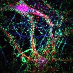 Intercellular-Nanotubes