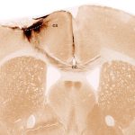 Mouse-Brain-After-Stroke-and-Neural-Stem-Cell-Transplantation-1200x675