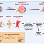 early-trigger-of-diabe