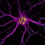 fat-particles-could-be