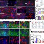 newly-identified-compo