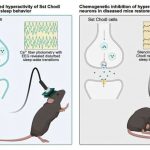 rare-brain-cell-may-ho