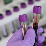 2-bloodtest