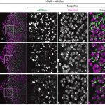 arginine-supplementati-1 (1)