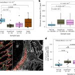 bowel-cancers-big-bang-2