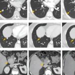 novel-liver-cancer-vac-1