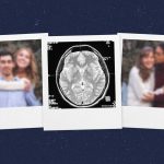 why-alzheimers-patient-1