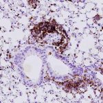 inflammation-fuels-one