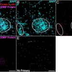 study-implicates-enzym