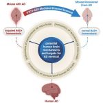 study-shows-alzheimers