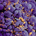 20220215-hiv-crop-768x598