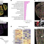 a-closer-look-at-how-l-1
