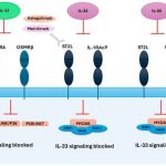atopic-dermatitis-unde-2