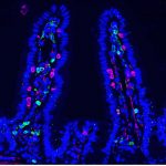 chemotherapy-rewires-g