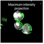 common-blood-protein-p