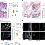 how-psoriasis-affects