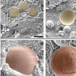 cholesterol-crystals-m-1