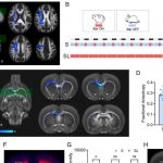 how-sleep-loss-can-dam