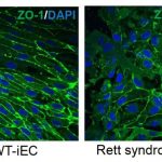 rett-syndrome-microrna