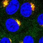 studies-identify-lipid