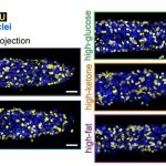 high-fat-diet-accelera