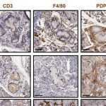 new-strategy-intercept