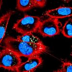 pro-inflammatory-macro