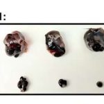 targeting-immune-suppr