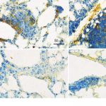 covid-19s-lingering-sh