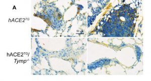 covid-19s-lingering-sh