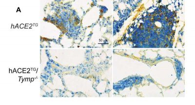 covid-19s-lingering-sh